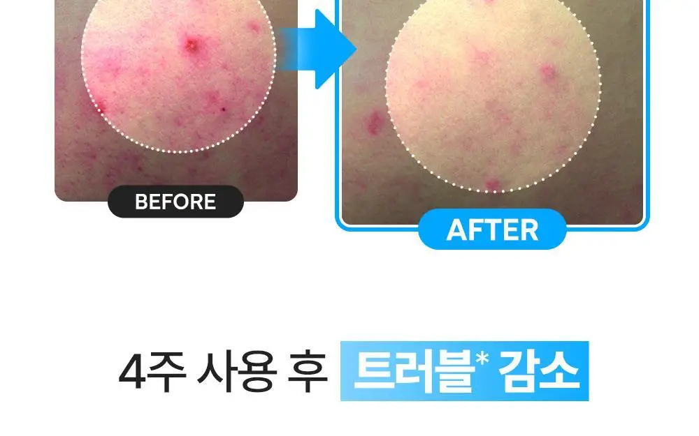 [NEW/열감쿨링] 닥터지 레드 블레미쉬 순무 시카 아이싱 패드 60매 리필 기획 (+60매 리필) 상세페이지 15